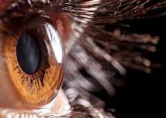 Paciente cego volta a enxergar com transplante de córnea impressa em 3D